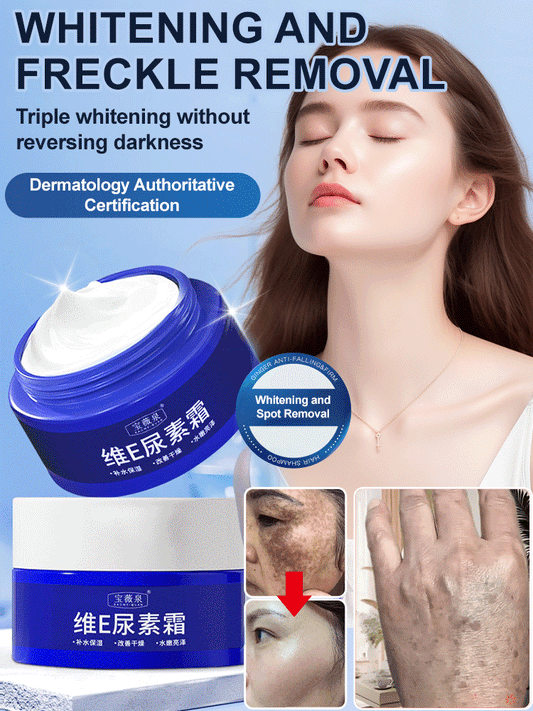 🎁2025 Hot Sale🎁Spot Fading Urea Cream